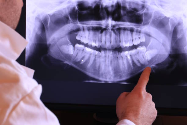 Best Emergency Dental Extractions in Yamhill, OR