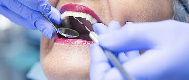 Best Emergency Root Canal Treatment in Yamhill, OR